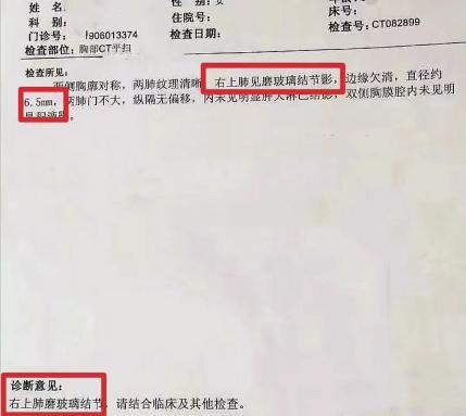 肝火犯肺引起6.5mm肺结节，仅仅三个月消散