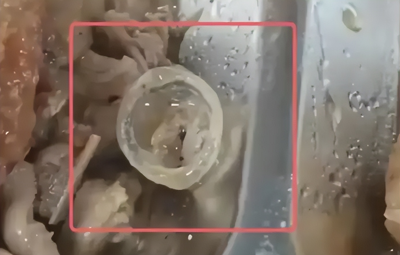 媒体评鸭眼球膜异物事件,鸭眼角膜事件