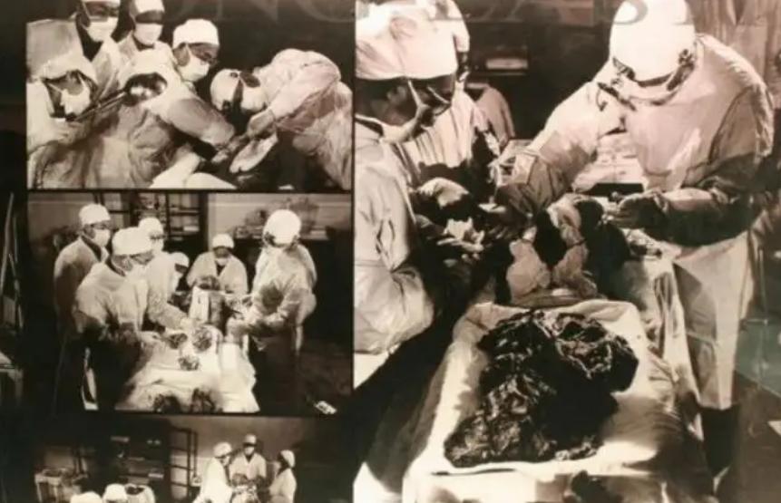 尸毒有那么厉害吗,古墓的尸毒真的存在吗