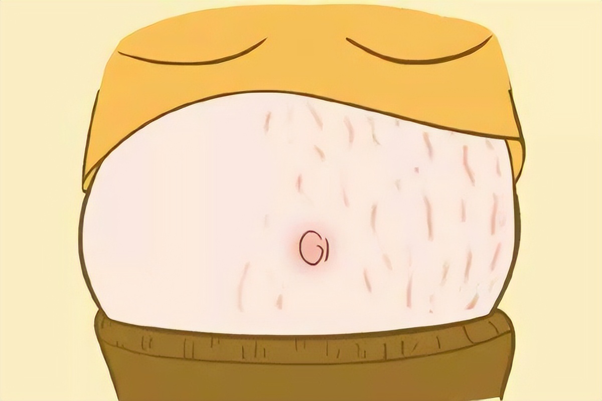 女生大腿有白色条纹是怎么回事,大腿和臀部有白色条纹怎么解决