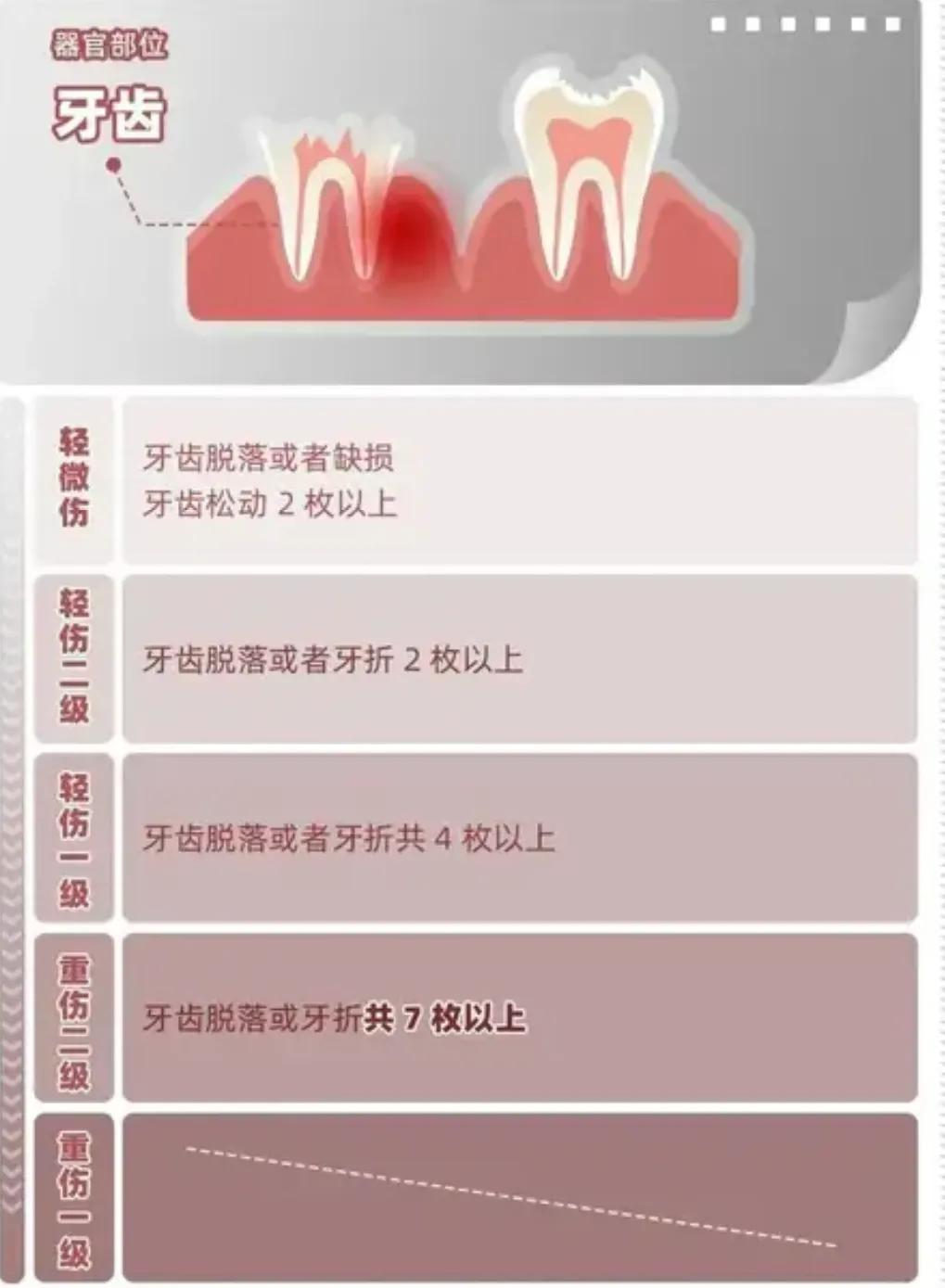唐山打人轻伤二级鉴定标准,唐山事件轻伤二级