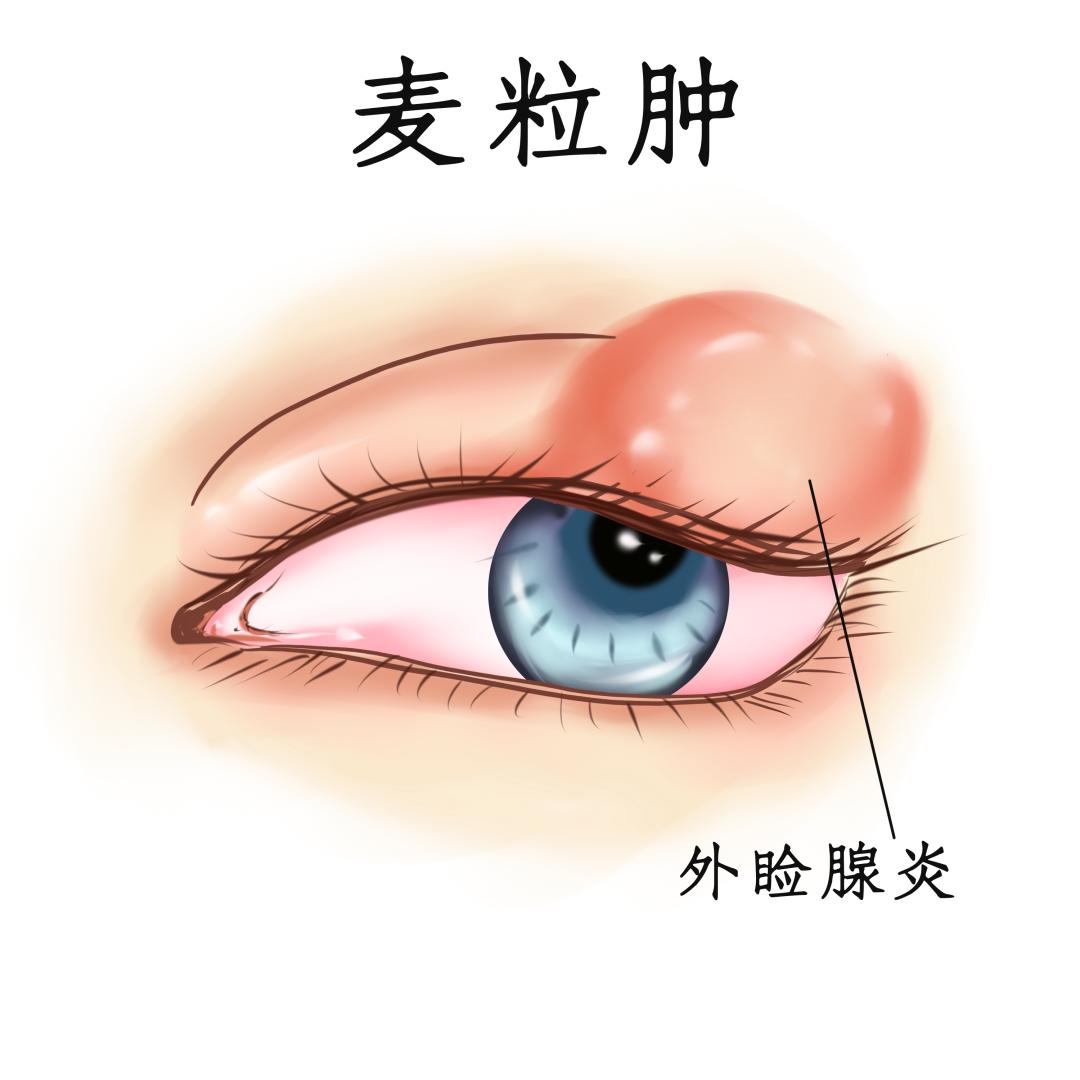 黄连上清片有清热解毒的作用吗,黄连上清片几块和十几块的区别