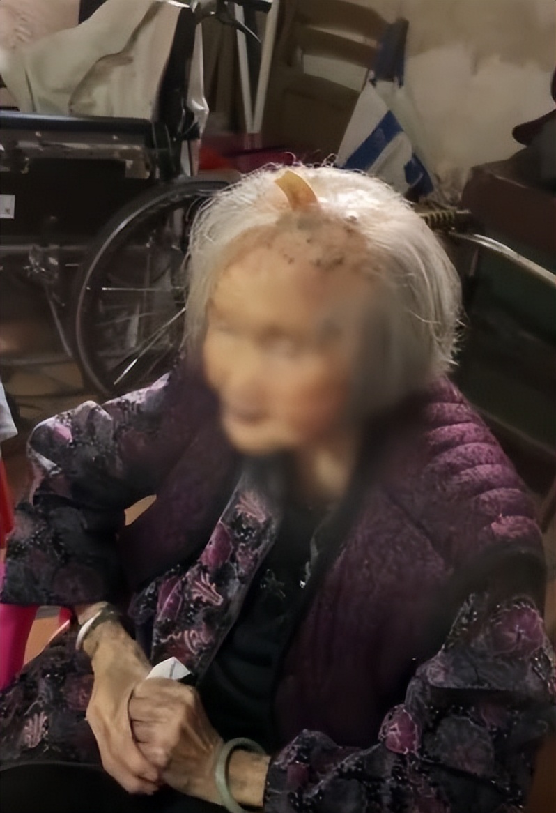 112岁老人头上长犄角,107岁老人头上有个长犄角