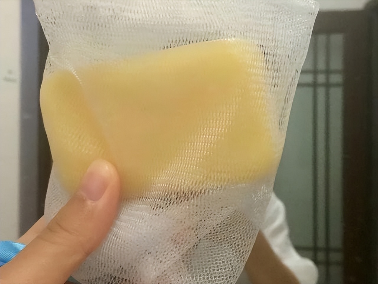 一女子坚持上海药皂洗头半年,一女子坚持硫磺皂洗头半年生发