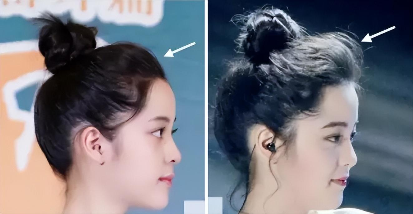 为什么大部分亚洲人都是扁头,正脸好看但侧脸丑到爆怎样办