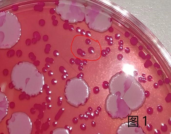 霉菌酵母菌检测方法视频,霉菌检验方法步骤