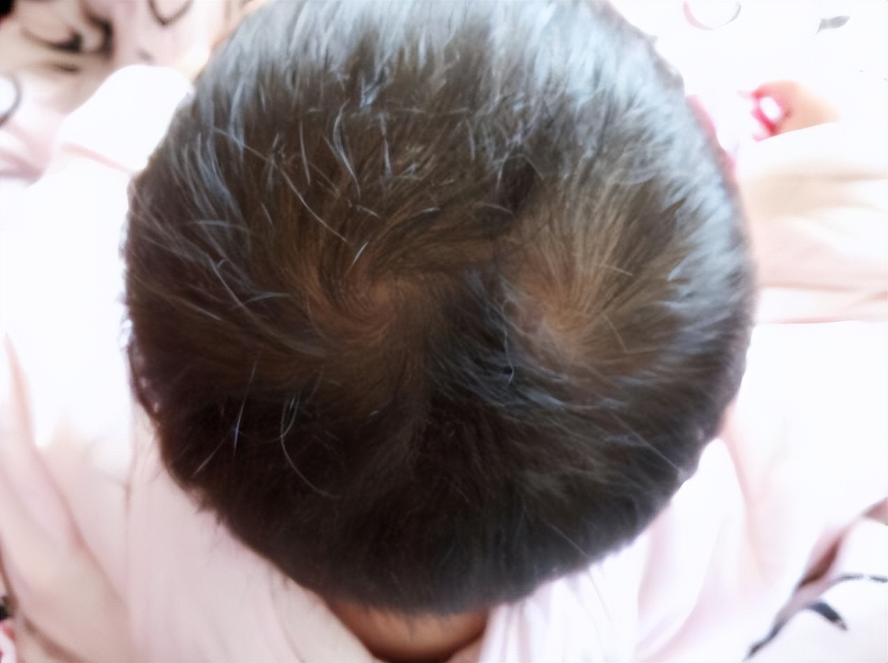 孩子头上的旋代表什么,小孩头顶的旋很重有什么寓意