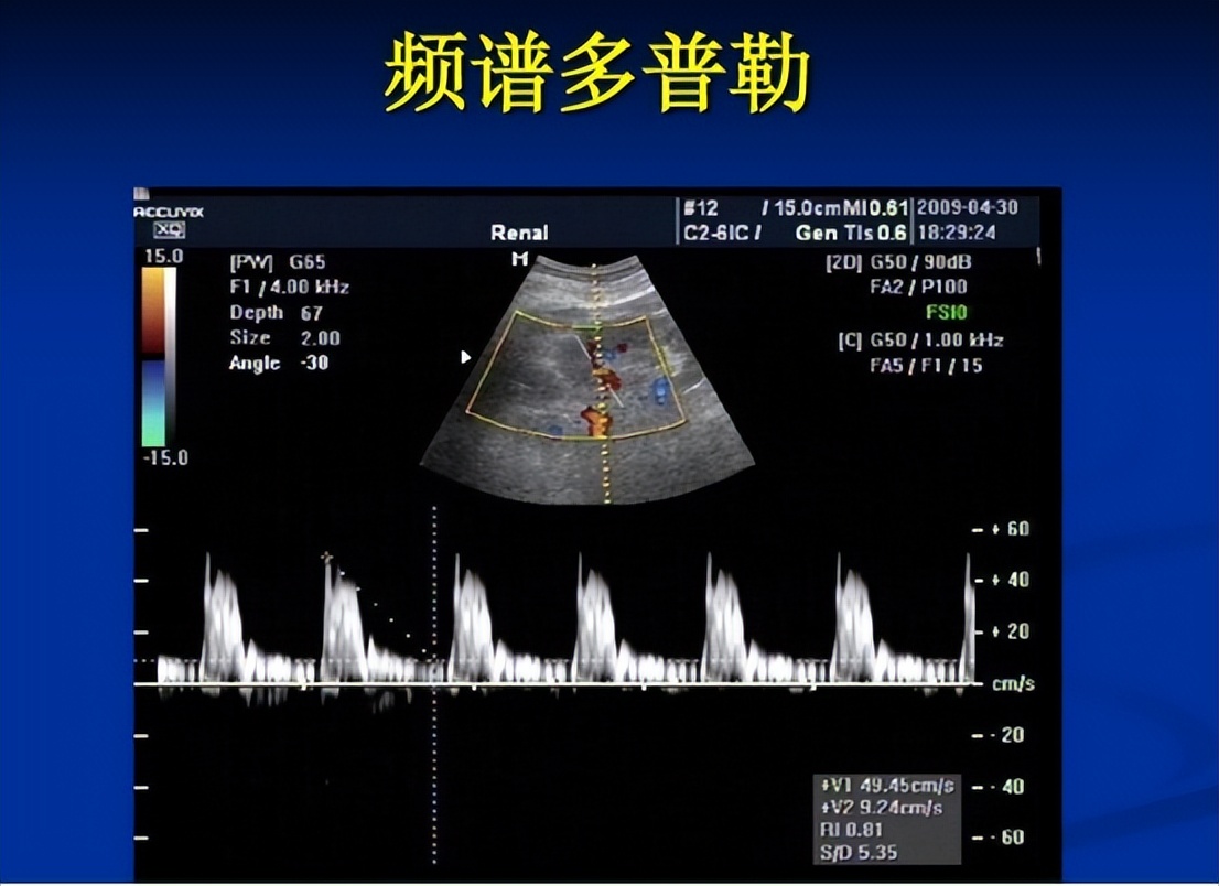 子宫性不孕要如何诊断,查不孕不育查出宫颈病变