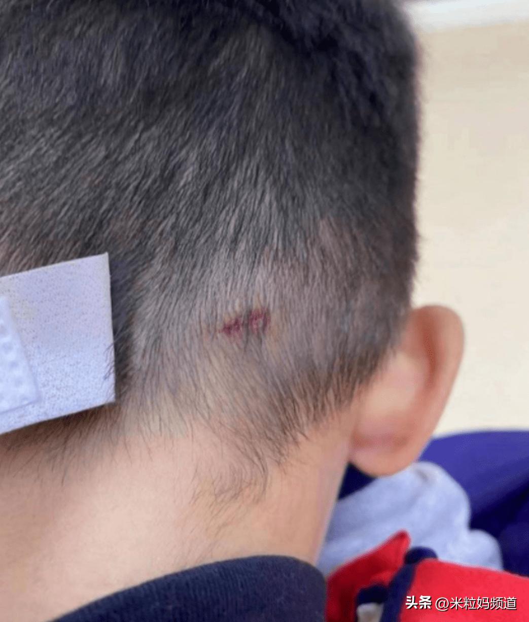 面对霸凌父母的反击,当孩子被欺负时妈妈霸气反击