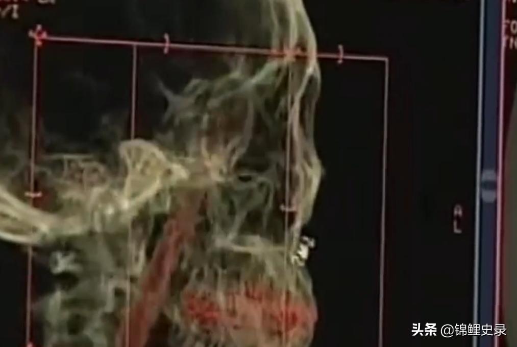 云南男子口臭骇人医生检查惊呼,云南男子口臭传奇故事