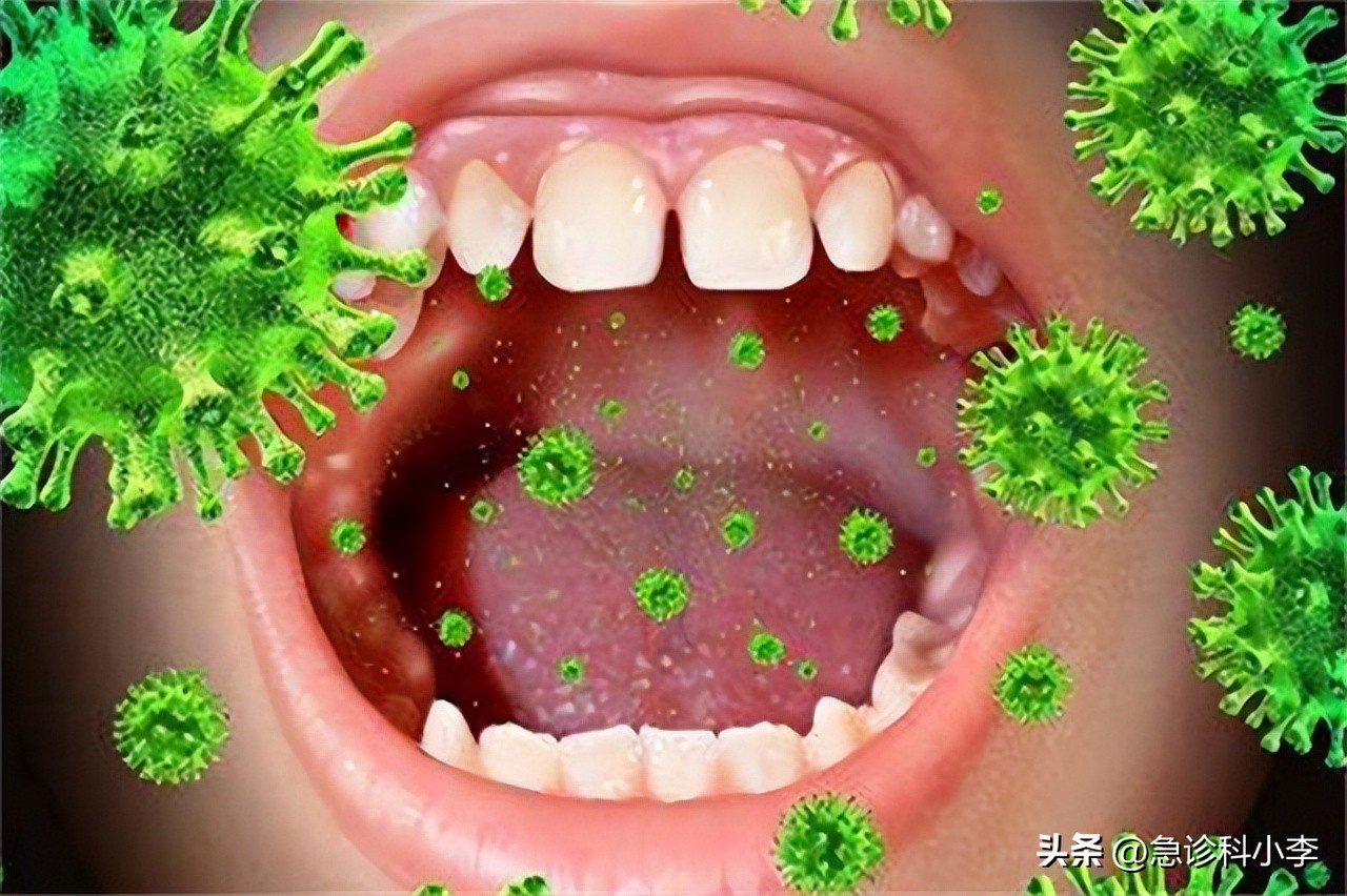 口腔癌有什么症状怎么预防,口腔癌的症状及如何预防
