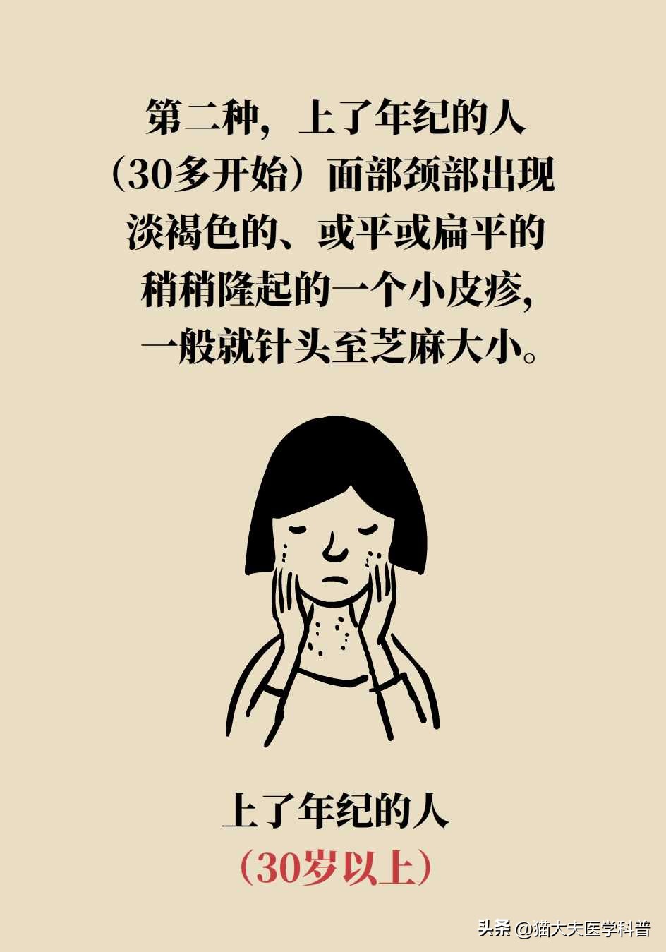 脖子上长的小肉揪怎么治啊,疣丝是不是脖子上的小肉粒