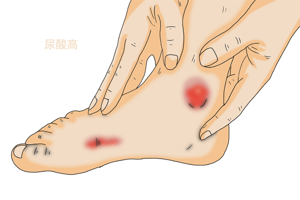 尿酸偏高者可以食豆类食物吗,尿酸偏高可以吃杂粮和豆类吗