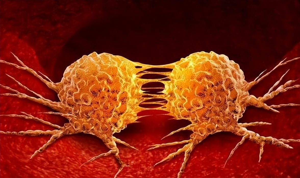 炎症到癌症一般多久,专家说长期炎症可能会拖成癌症