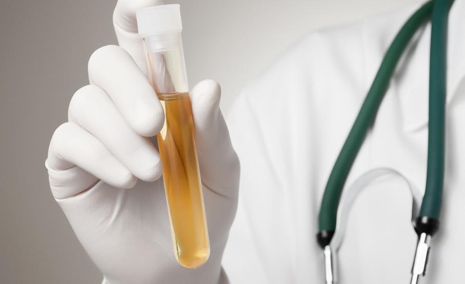 阿莫西林不能乱吃这五种病才有效,阿莫西林或许只对5种病有效