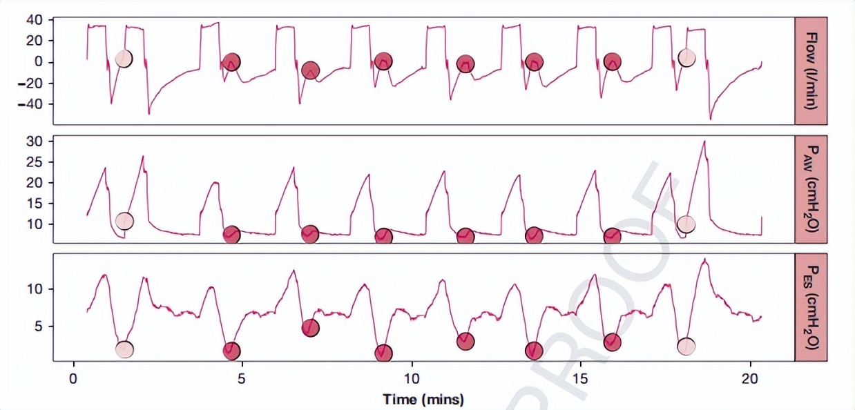 罗红教授,机械通气波形分析和临床应用