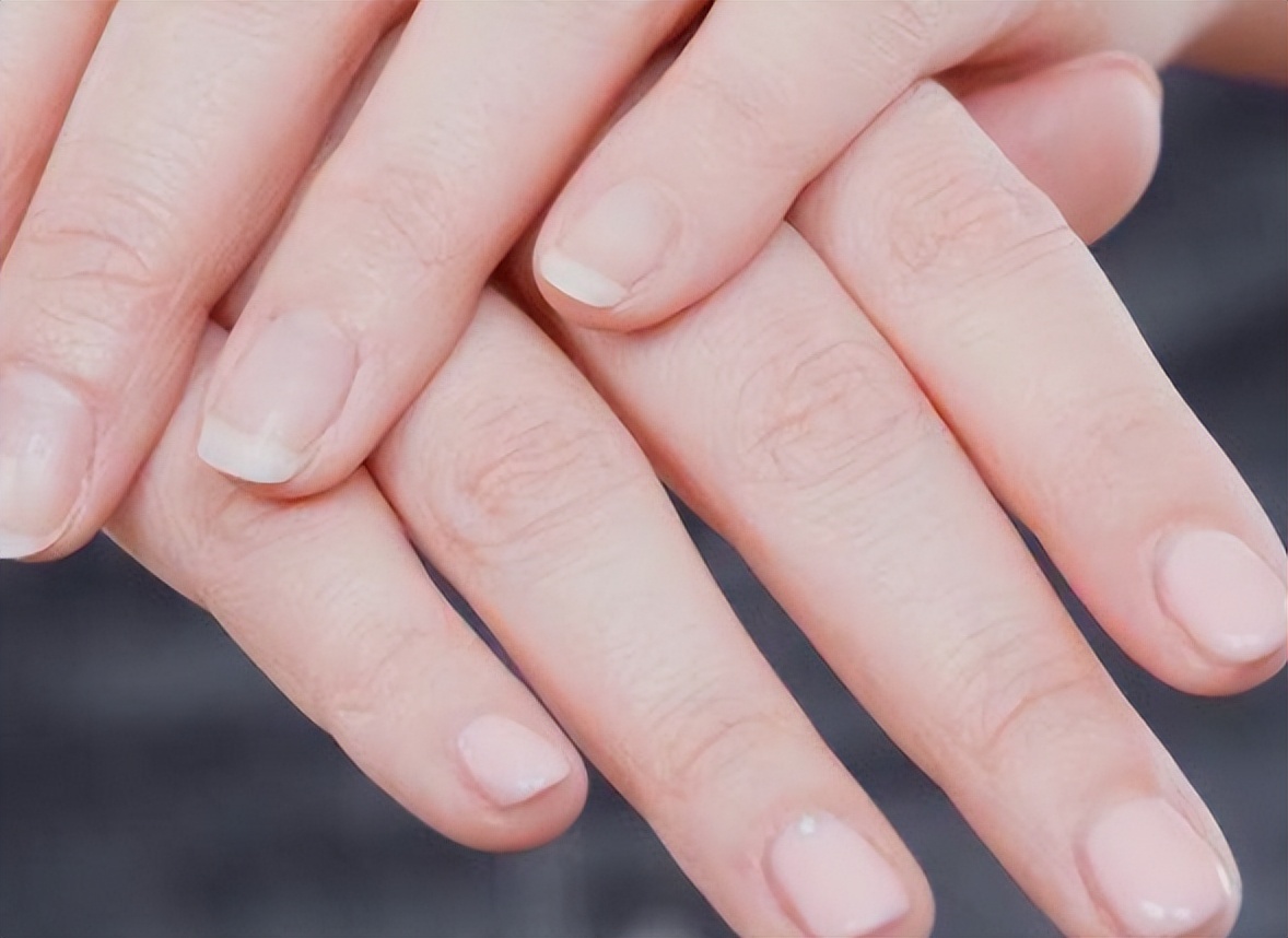 手指有竖纹是肝不好的表现吗,手指甲竖纹没有月牙是肝不好么