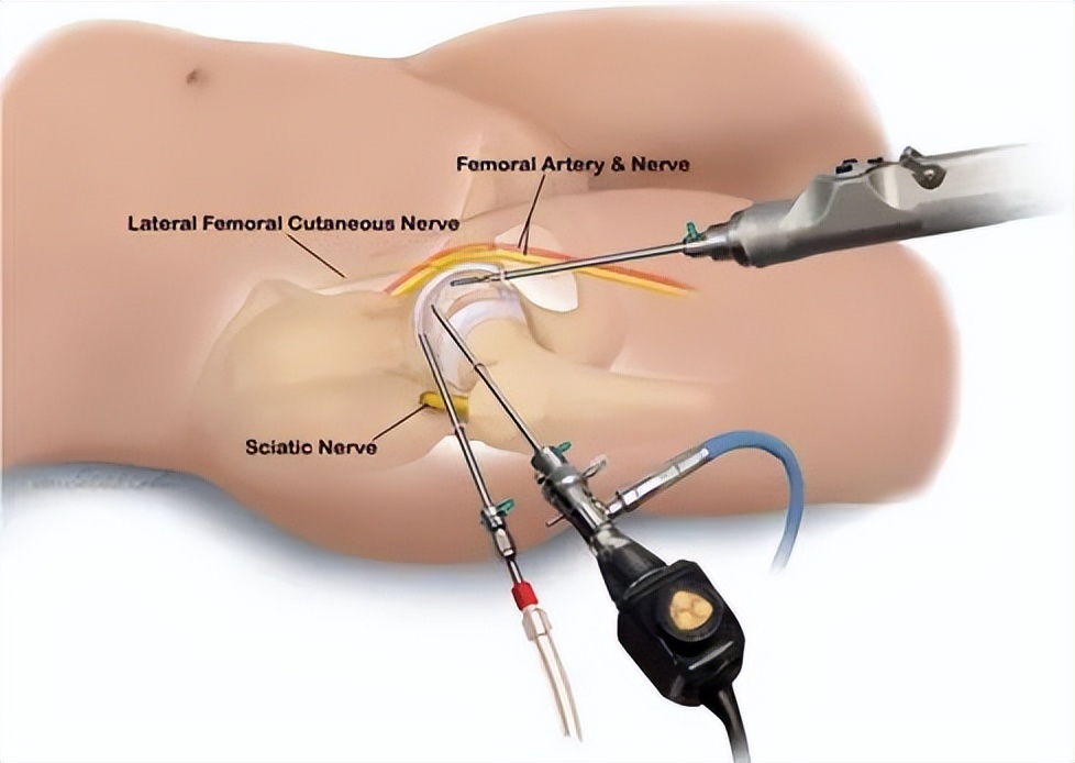 骨头关节损伤怎么治,关节骨头疼痛解决最好办法