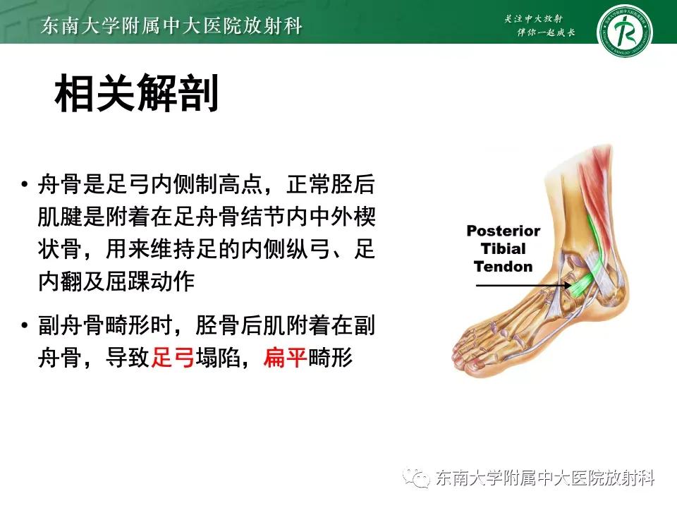 好文分享-《肌骨系统疾病——副舟骨综合征》