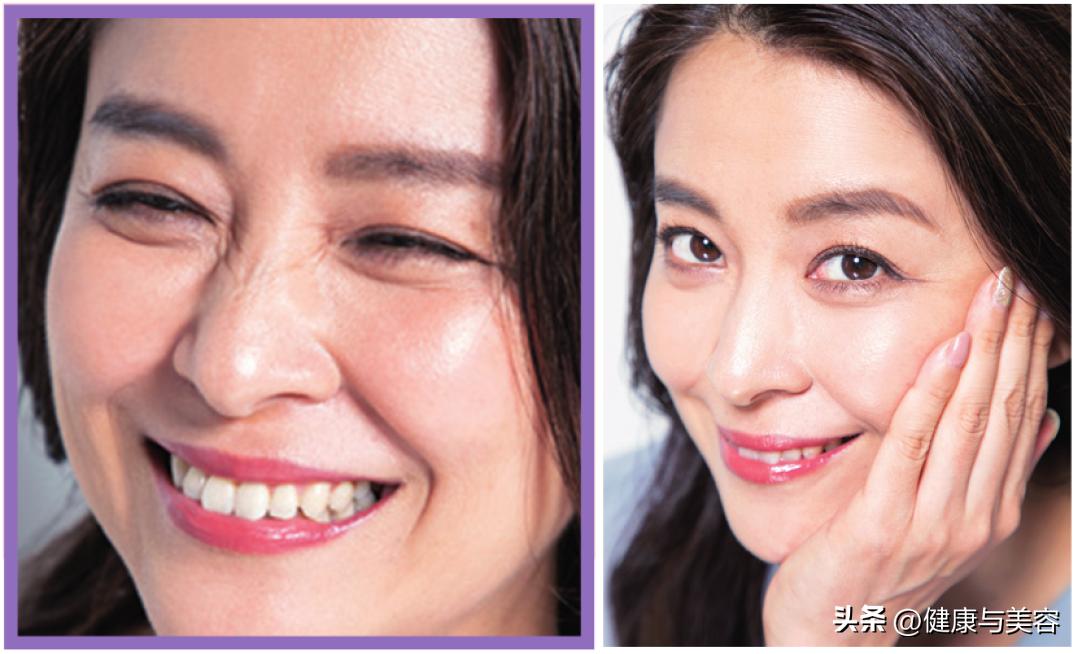 眼部皱纹抗皱,眼部抗衰去皱纹