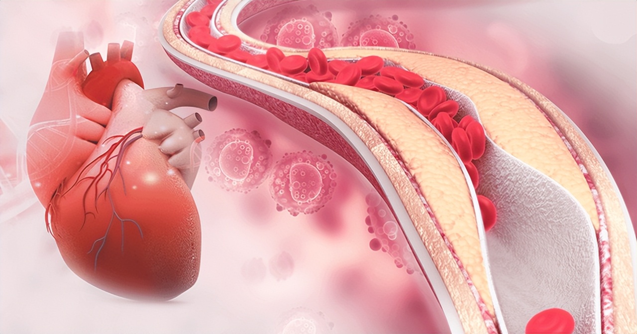 关于心脏供血不足的治疗方法,心脏供血不足怎么预防和治疗