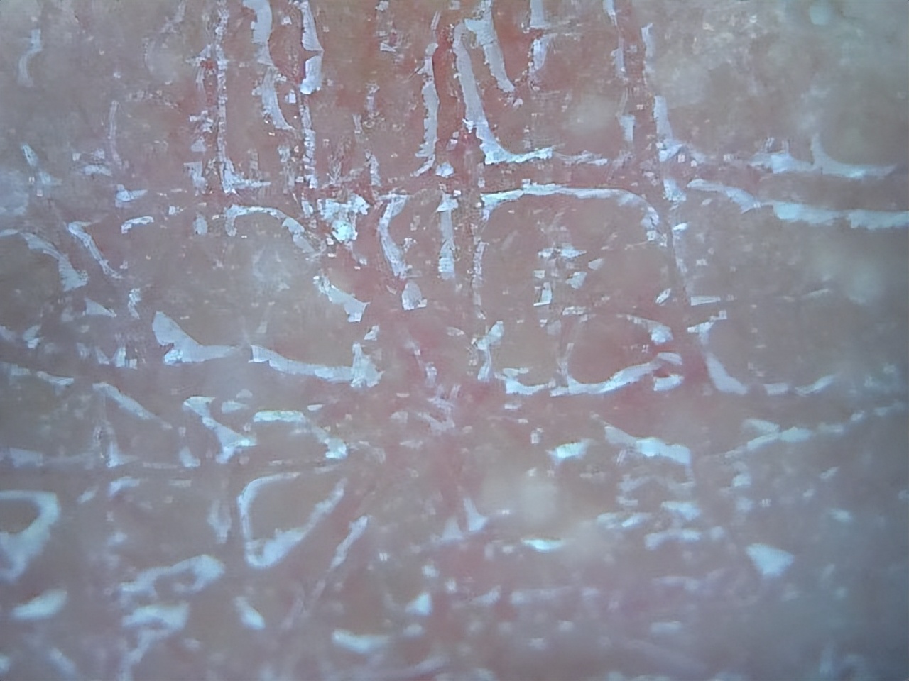 每到秋天，手和腿上就会出现各种干燥情况，还会脱皮，要怎么办？