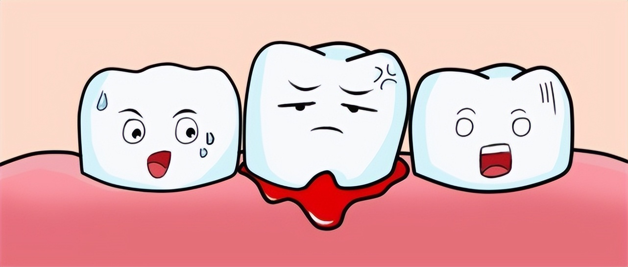 儿童满口蛀牙该怎么护理牙齿,上海孩子有蛀牙牙疼怎么办