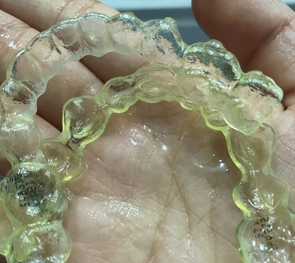 牙齿矫正过程口腔护理,口腔科普牙齿矫正的十大误区