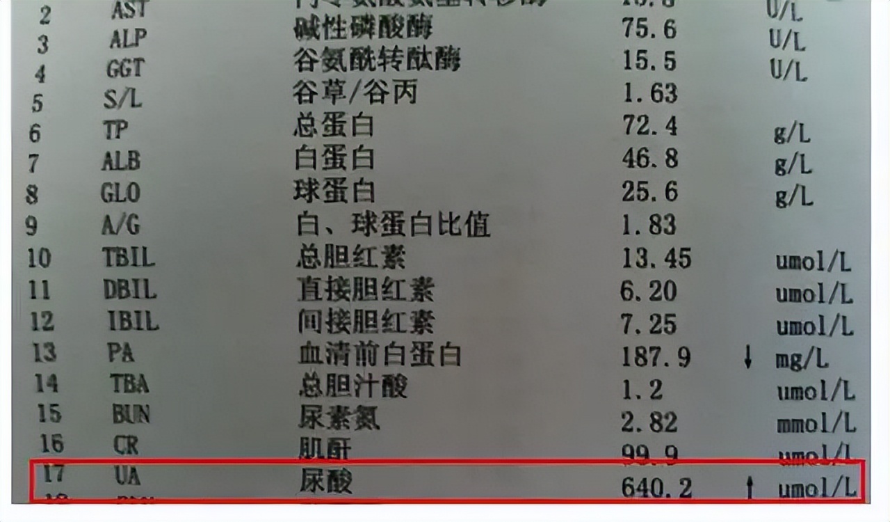 痛风尿酸降下来了还要继续吃药吗,尿酸485有痛风症状不吃药可以吗