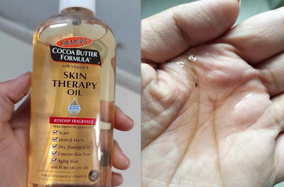 消除妊娠纹是不是智商税,去除肥胖纹妊娠纹产品