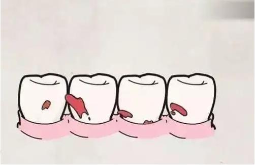 牙刷电动牙刷是智商税吗,u型牙刷是智商税吗