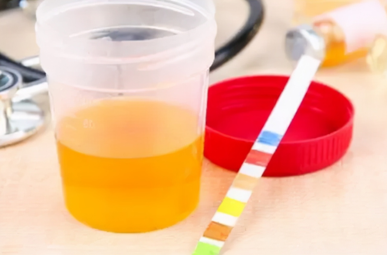 蛋白质吃多了会伤肾,蛋白质吃多危害