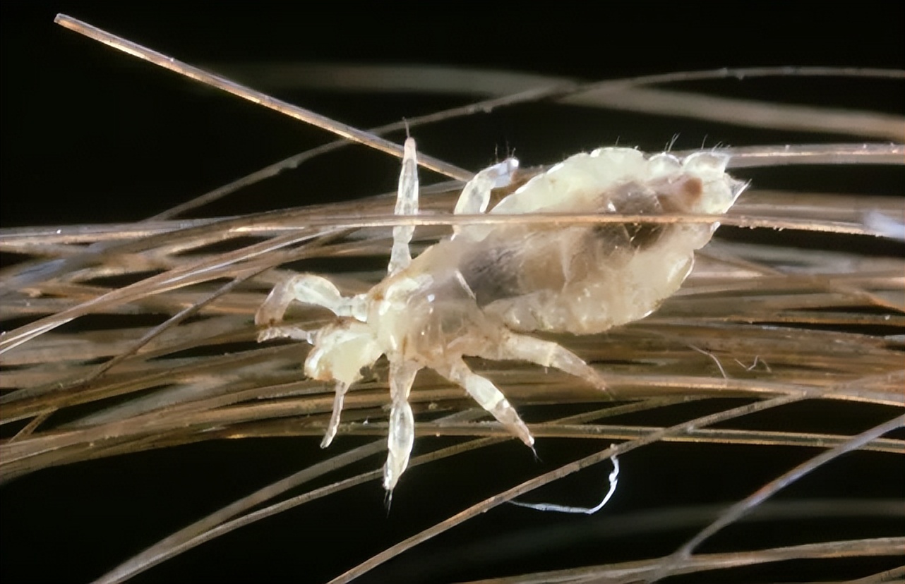 曾经无孔不入的虱子是怎么来的？为何如今很少看到了？