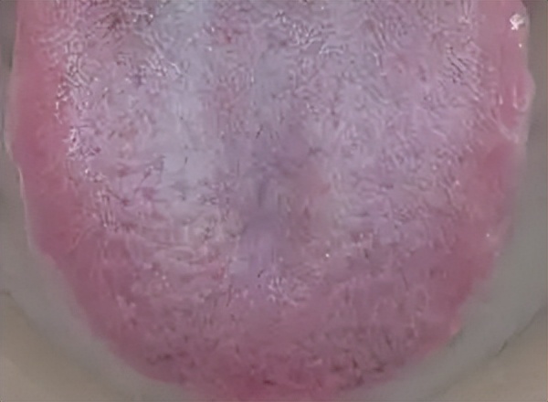 中医治疗乳腺癌有什么好方案,中医治疗乳腺癌有什么方法