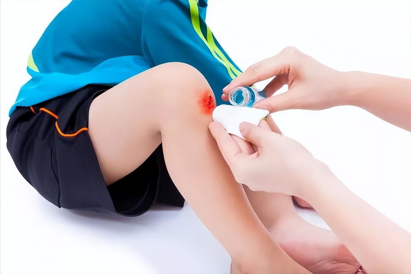 激光祛痣祛斑怎样护理才能快点好,激光治疗咖啡斑后护理