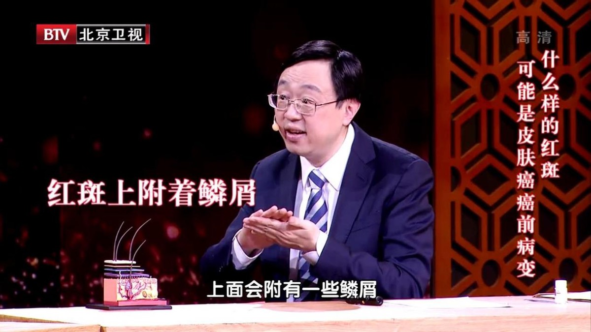 皮肤上有黑点是癌症的前兆吗,皮肤长出红点要注意癌症的表现