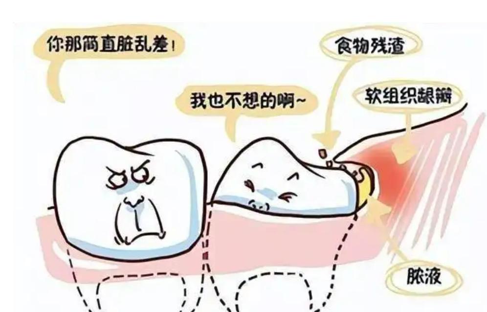 牙床有残根20多年了需要拔掉吗,牙只剩下残根了没法接需要拔掉吗