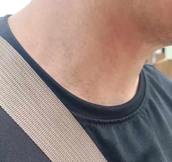 四川一女子网购黑色短袖，丈夫穿上变“透明装”，脱下后全身变色