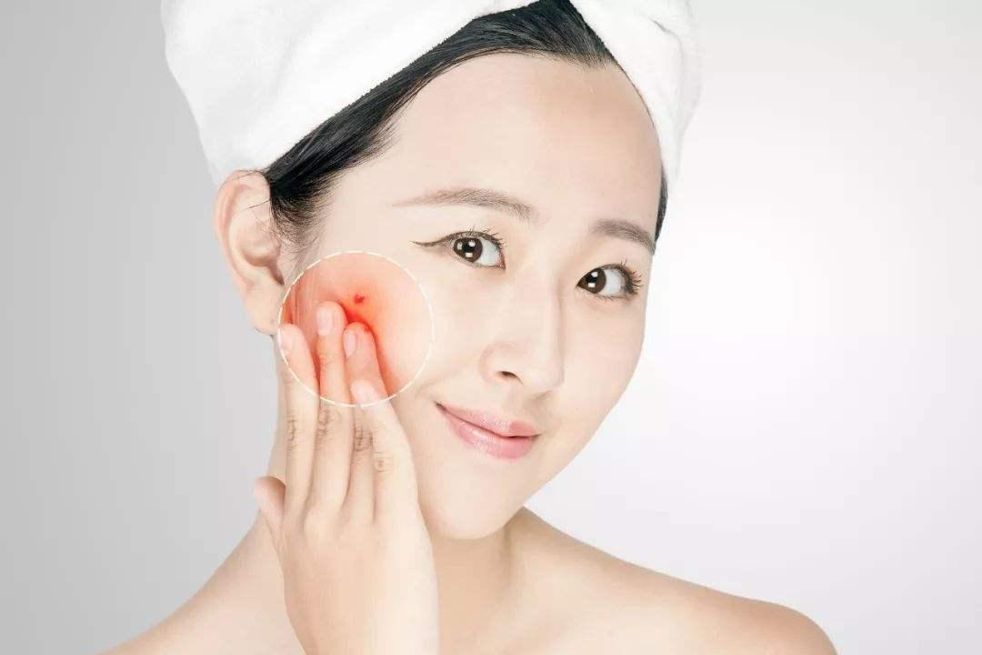 头孢和阿莫西林是一个性质吗,头孢和阿莫西林有啥区别和不同