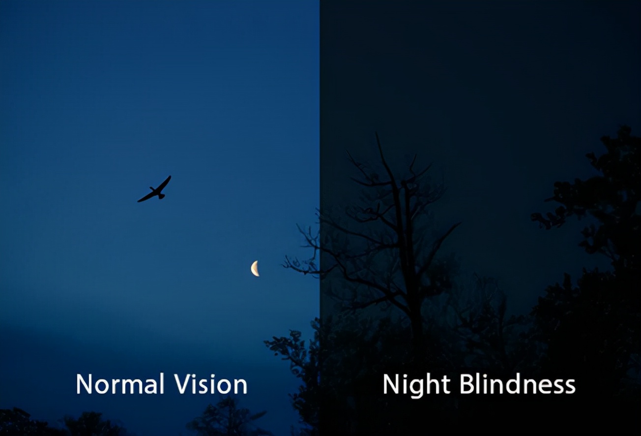 眼睛有哪些疾病和症状,眼睛5种迹象是疾病表现