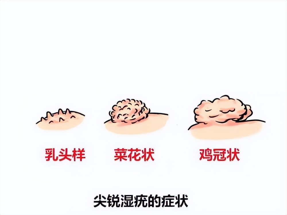 怎么在*生活性**前，判断对象有没有性病？