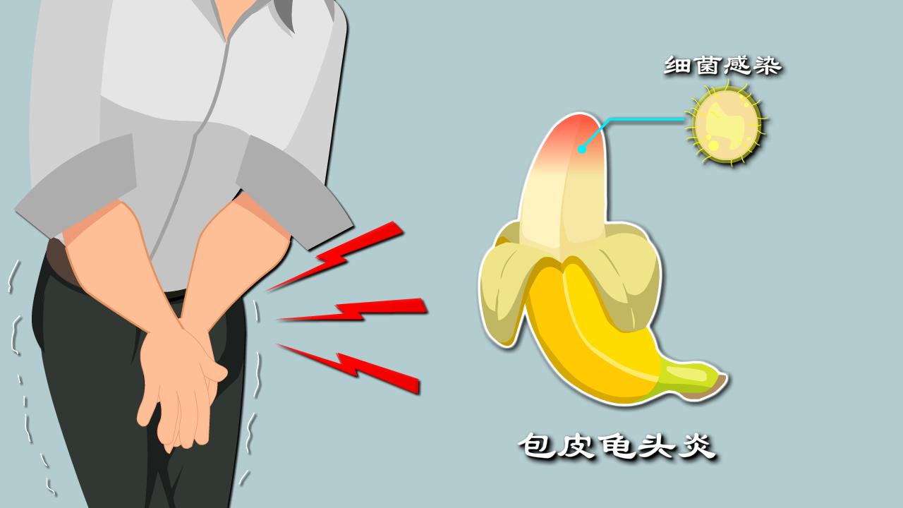 丁丁瘙痒？阳痿*泄早**背后真相是啥？暖心科普包皮*头龟**炎发病机制