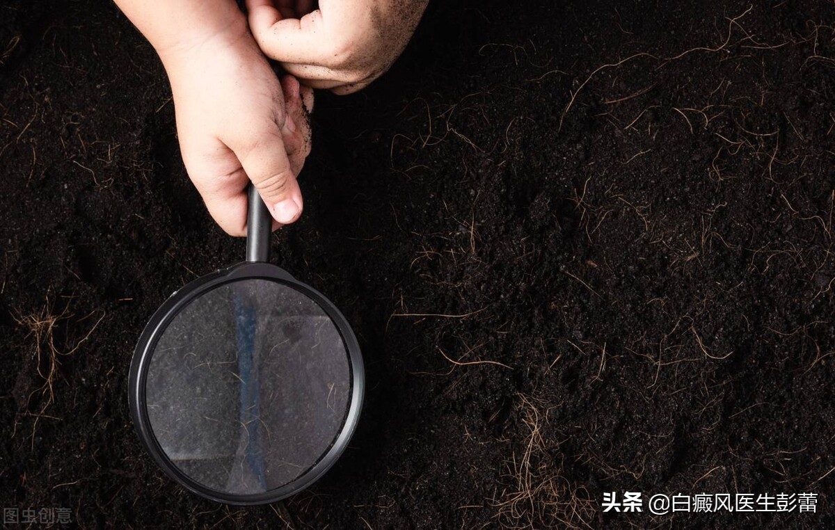 伍德灯下白斑颜色代表什么？一起来看看