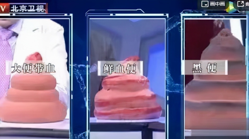 痔疮洗屁股刺痛怎么办,屁股清洗不干净会有瘙痒症状吗