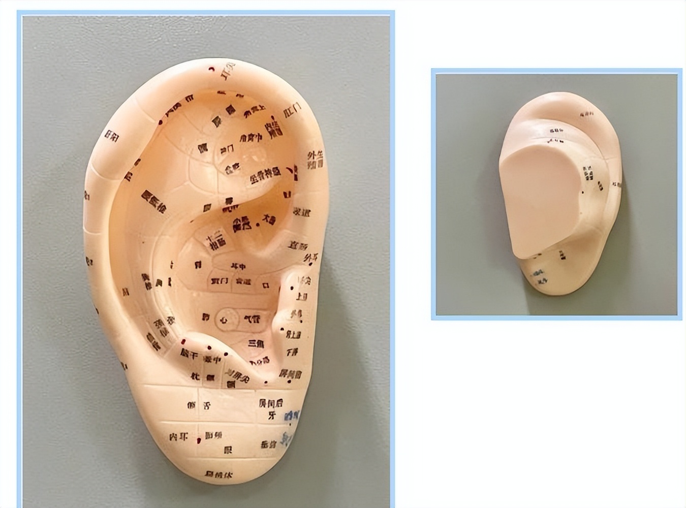 表情不受管理怎么办,表情不受控制是什么病
