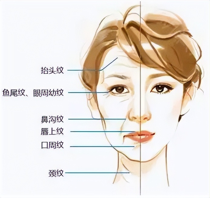 除皱用哪种方法比较好,除皱效果最好的几种方法