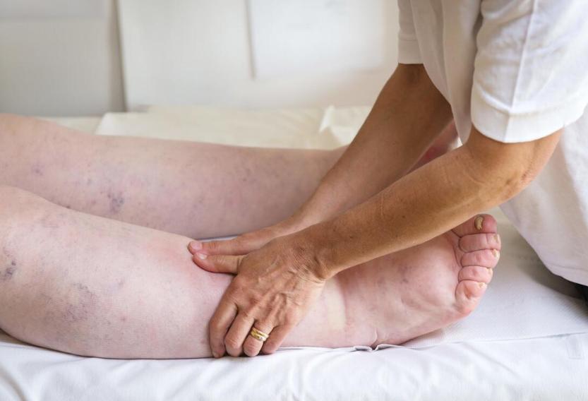 夏天出汗多排尿少对降尿酸影响吗,多运动尿酸能降低吗