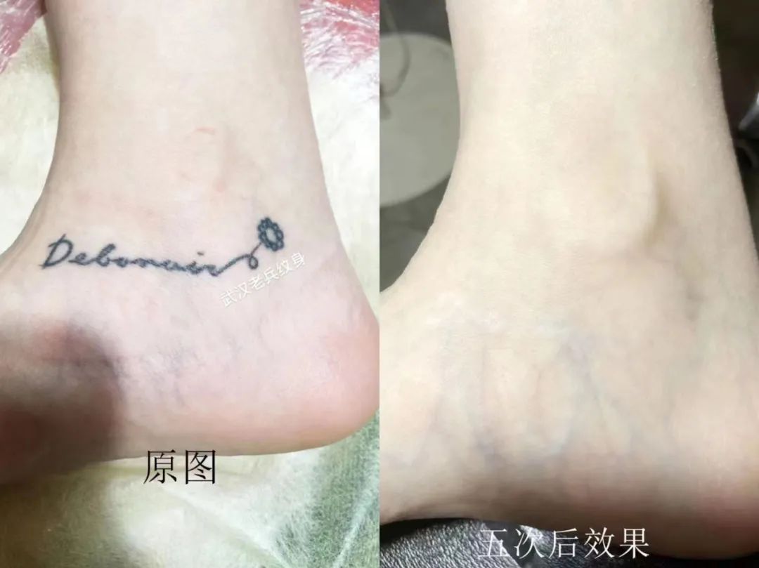 怎样洗纹身对皮肤的损伤小,不伤皮肤的洗纹身方法