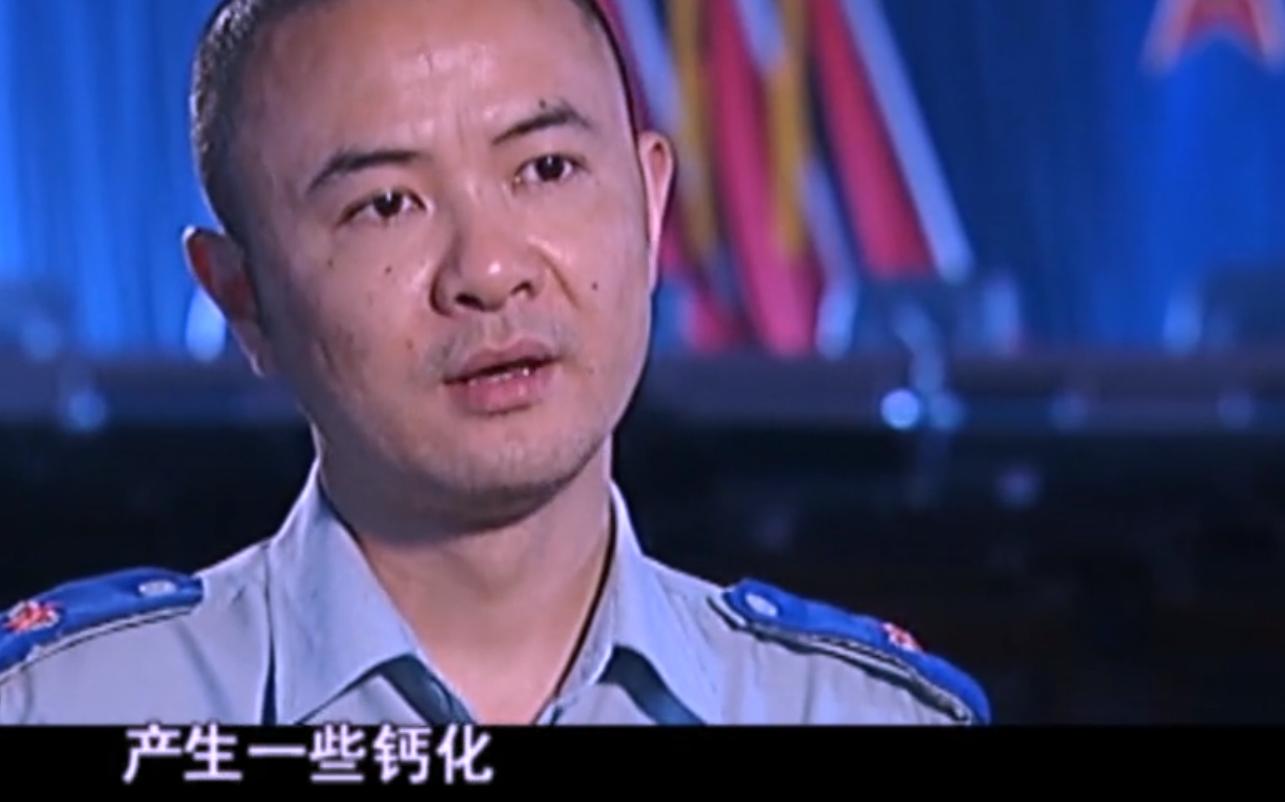 2007年四川90岁老妇，腹中怀子60年未生，后检查发现胎儿没有腐烂