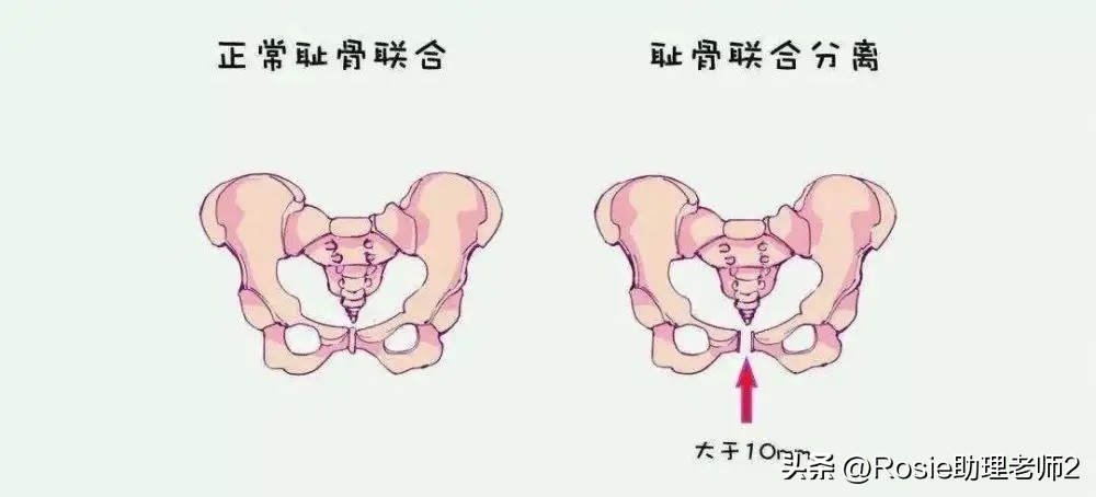 谢娜产后恢复,谢娜产后如何修复